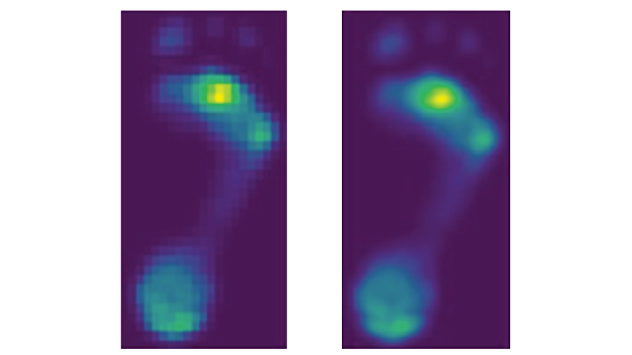Footscan 比較