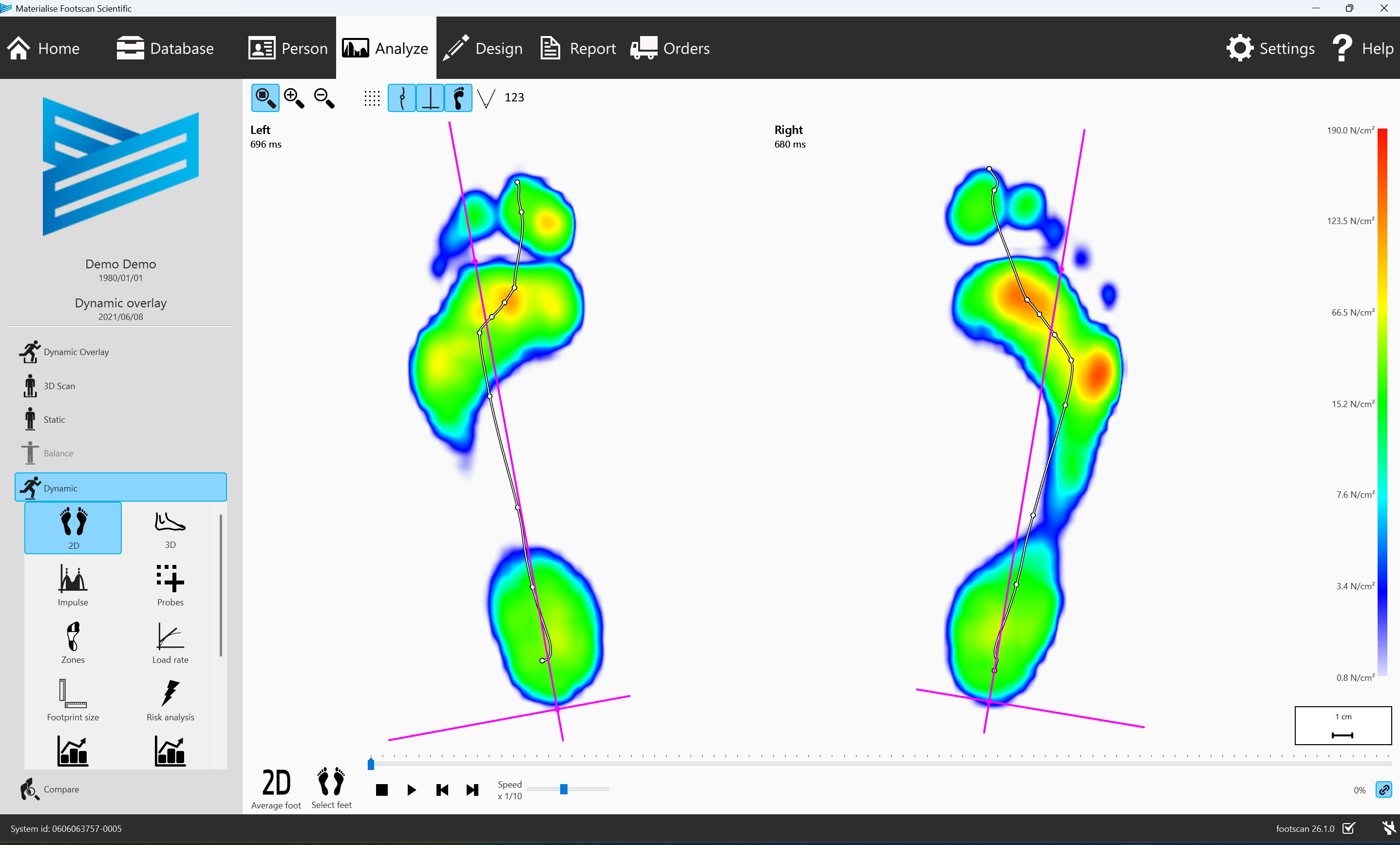 Footscan ソフトウェア　v9 Essentials